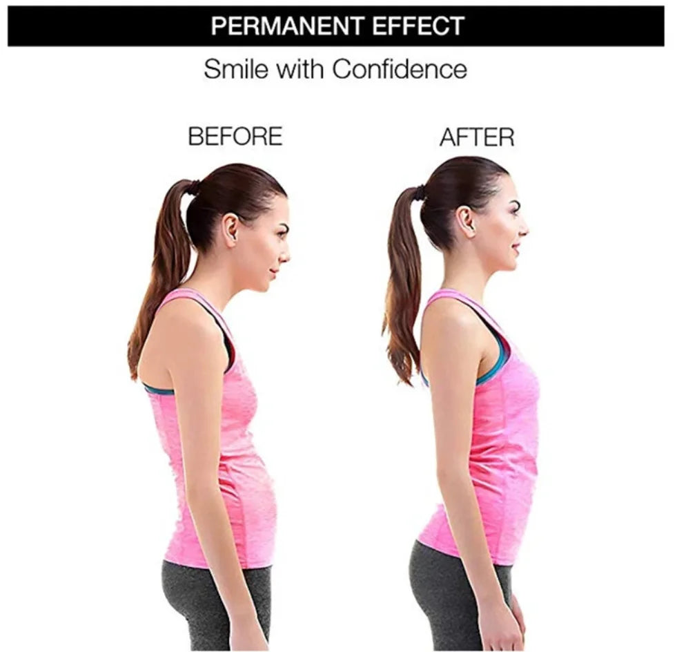 Back Shoulder Posture Corrector Beauty Boost